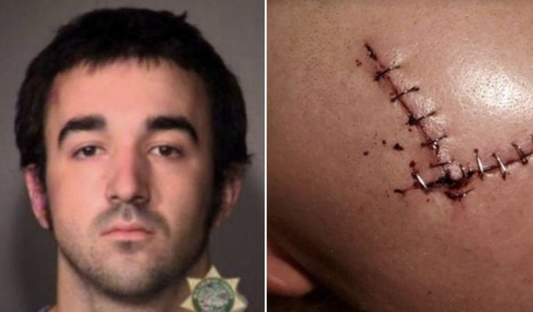 ANTIFA Member Gage Halupowski Sentenced To Nearly 6 Years In Prison For Brutal Assault