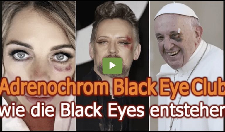 Adrenachrome “Black Eye Club” Finally Exposed In Detail…