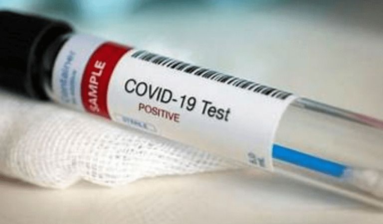 BREAKING: Agency Review Confirms COVID-19 Test Kits ‘Contaminated’ After Production; Featured Initial Design Flaw