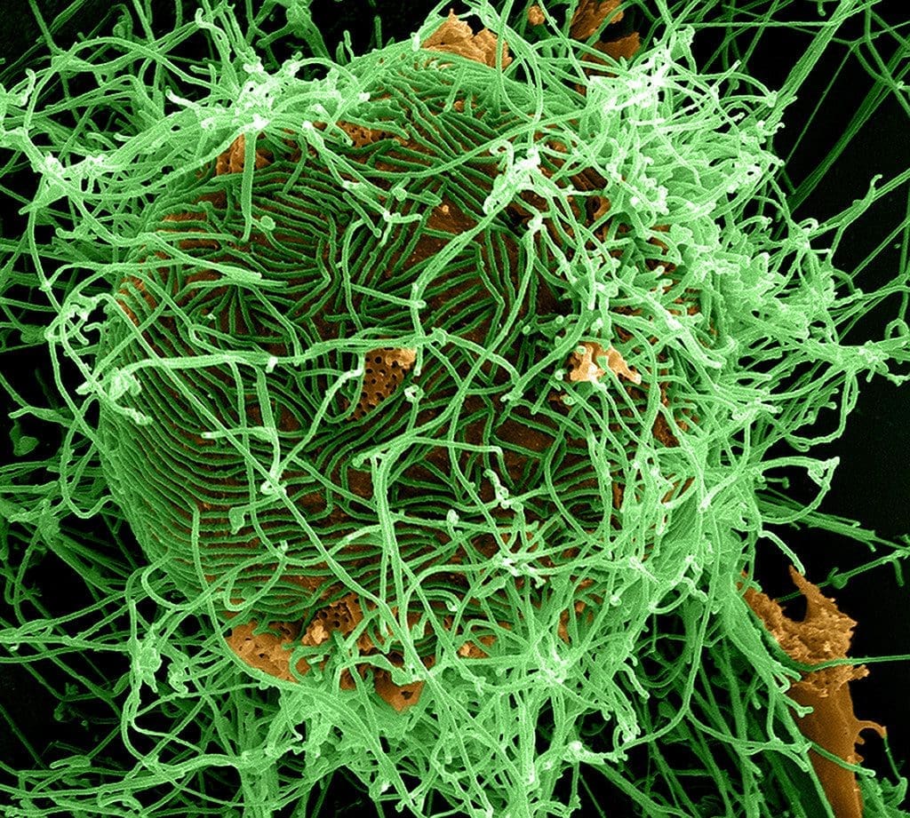 Scientists Claim US-Funded Biolab May Have Caused 2014 West African EBOLA Outbreak